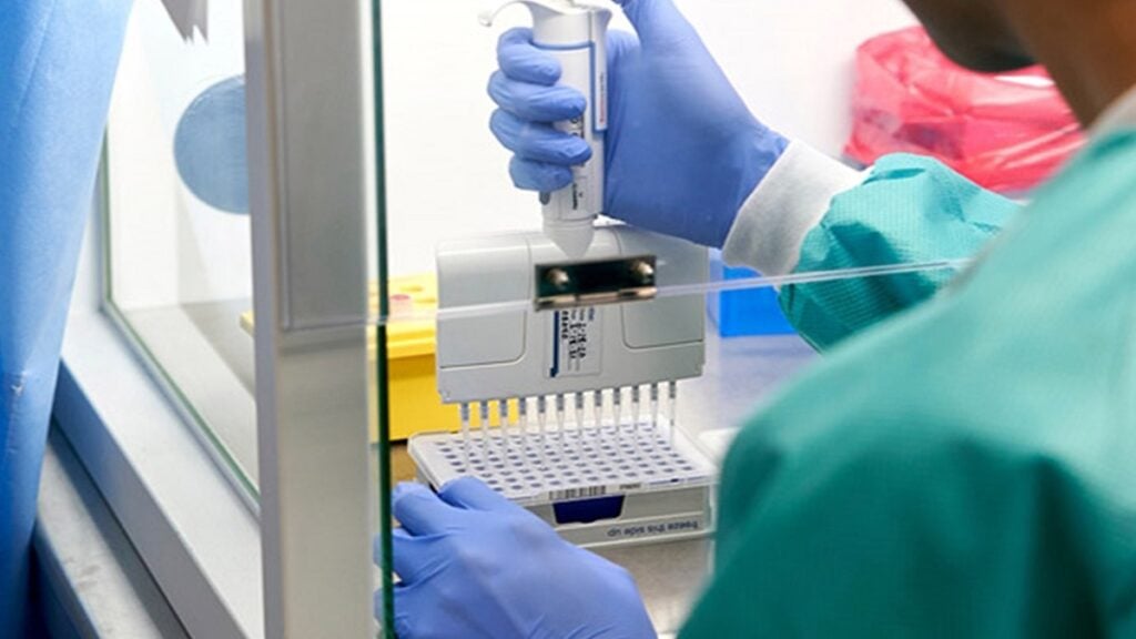 pcr testi sonucu nereden alınır